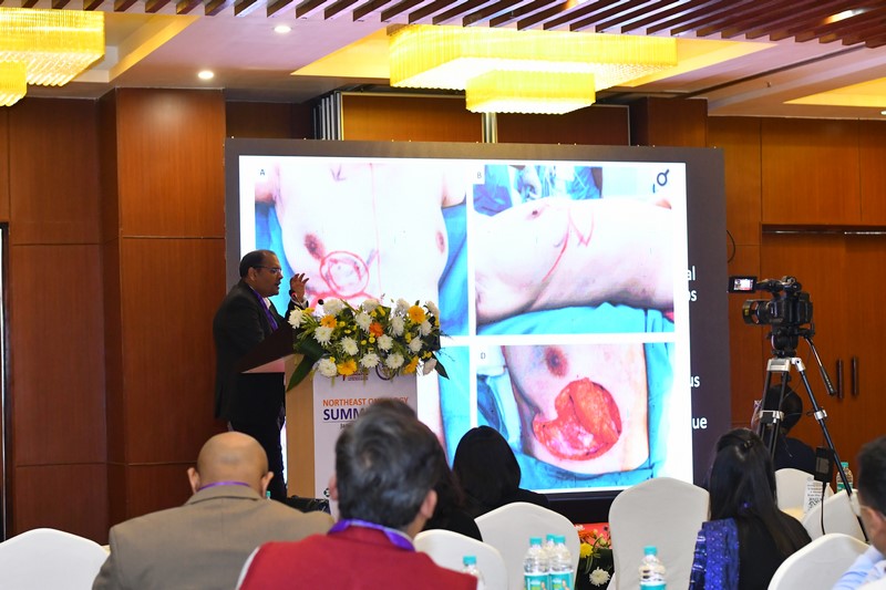 Northeast Oncology Summit (NEOS) 2024 – Dibrugarh Edition Northeast Oncology Summit (NEOS) 2024 – Dibrugarh Edition